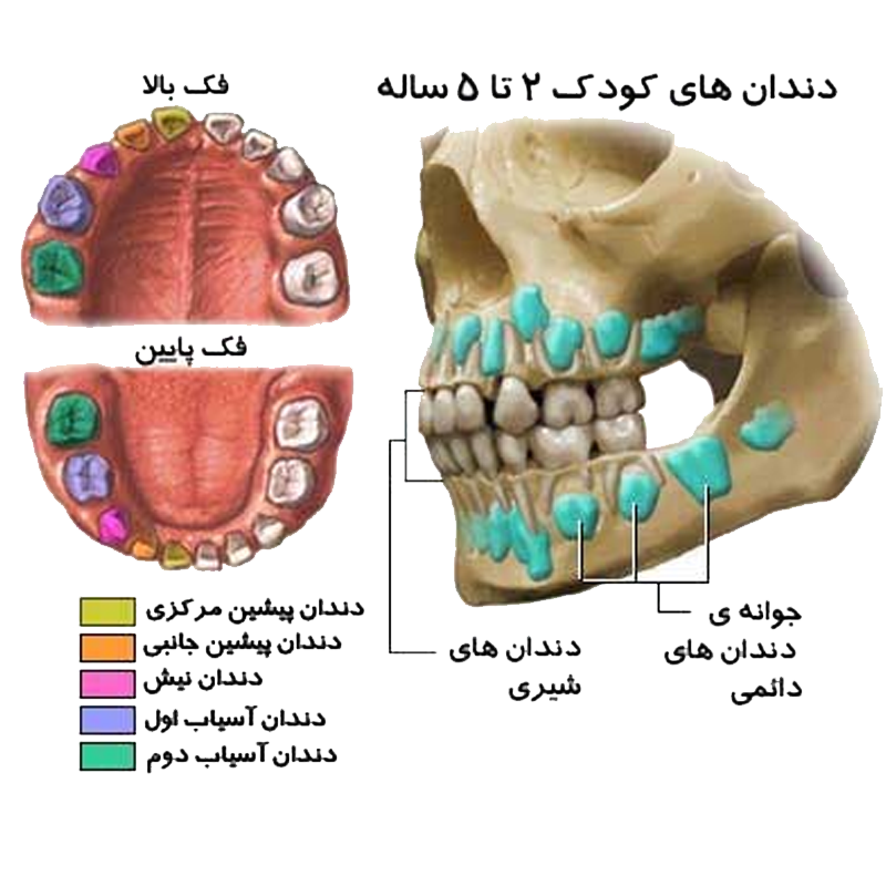 پوسیدگی دندان شیری به  دائمی