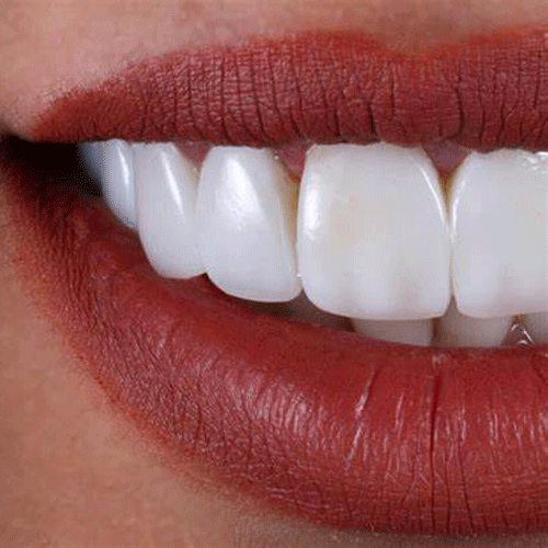 مینای دندان-Tooth Enamel