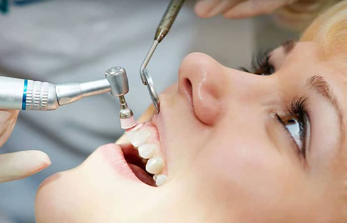 مراقبت‌های جرم گیری دندان